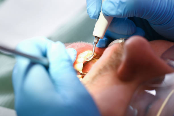 Best Walk-In Emergency Dentist in Carrollton, VA