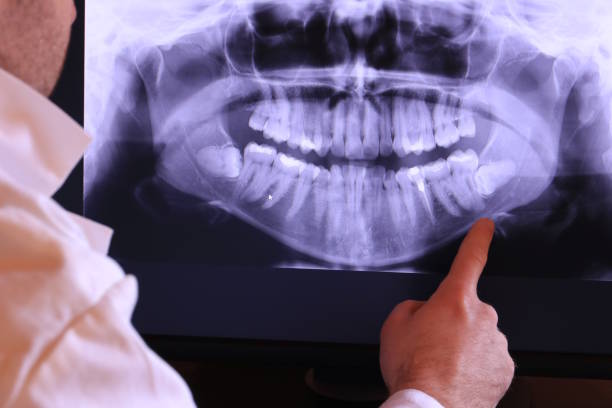 Best Emergency Treatment for Toothache in Carrollton, VA